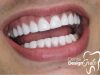 Dental Design Smile