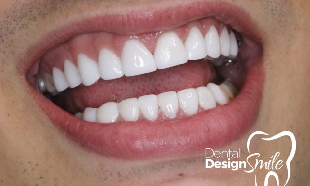 Dental Design Smile