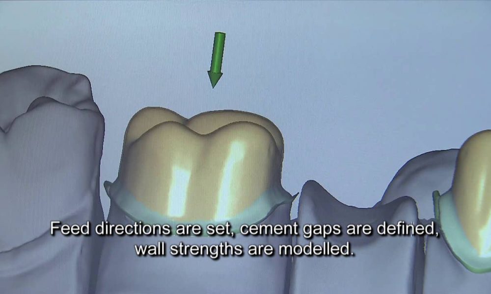 ODALI'S CERAMIC DENTAL LAB