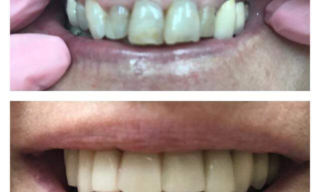 Zentistry Dental – Aponte Esperanza DDS