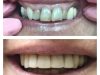 Zentistry Dental - Aponte Esperanza DDS