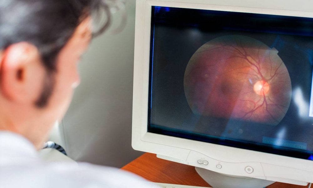 Eye Doctors Of South Florida