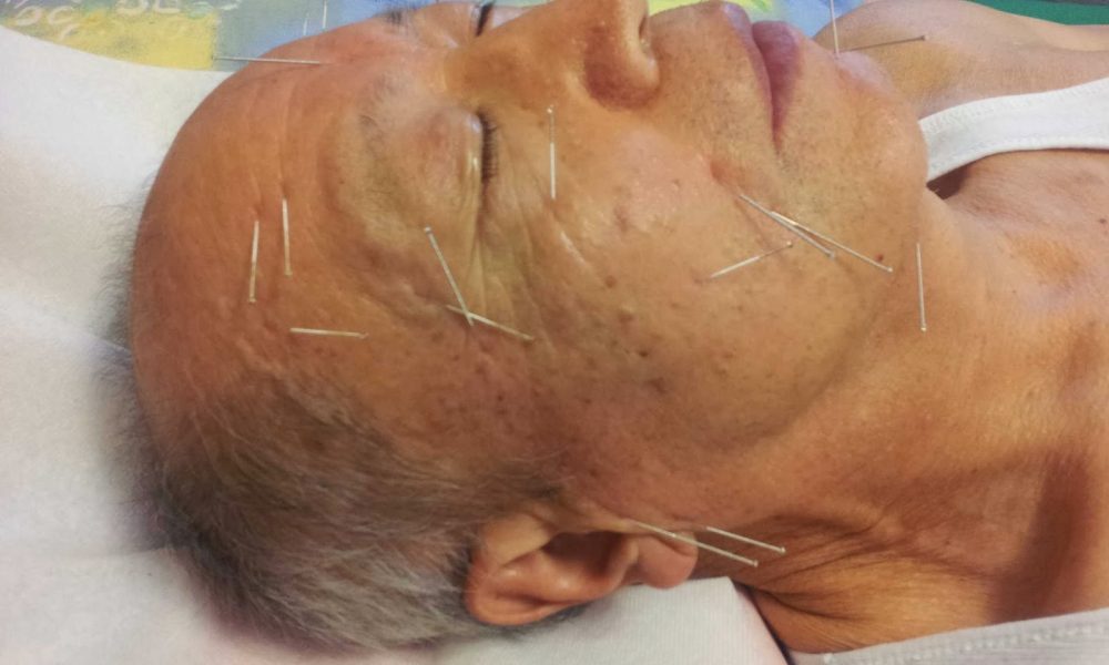 Lifetree Acupuncture & Herbal Medicine