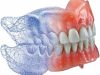 Laboratorio MECANICO Dental Protesis Dentales flexibles